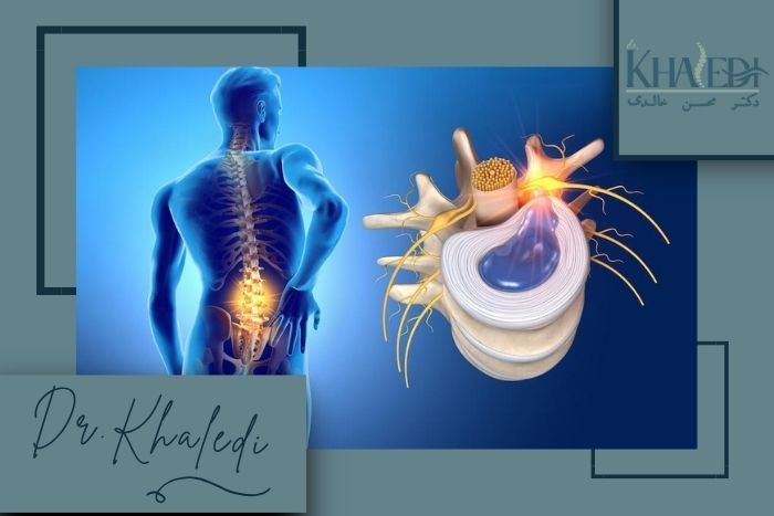 علائم دیسک کمر در پاها را بشناسید