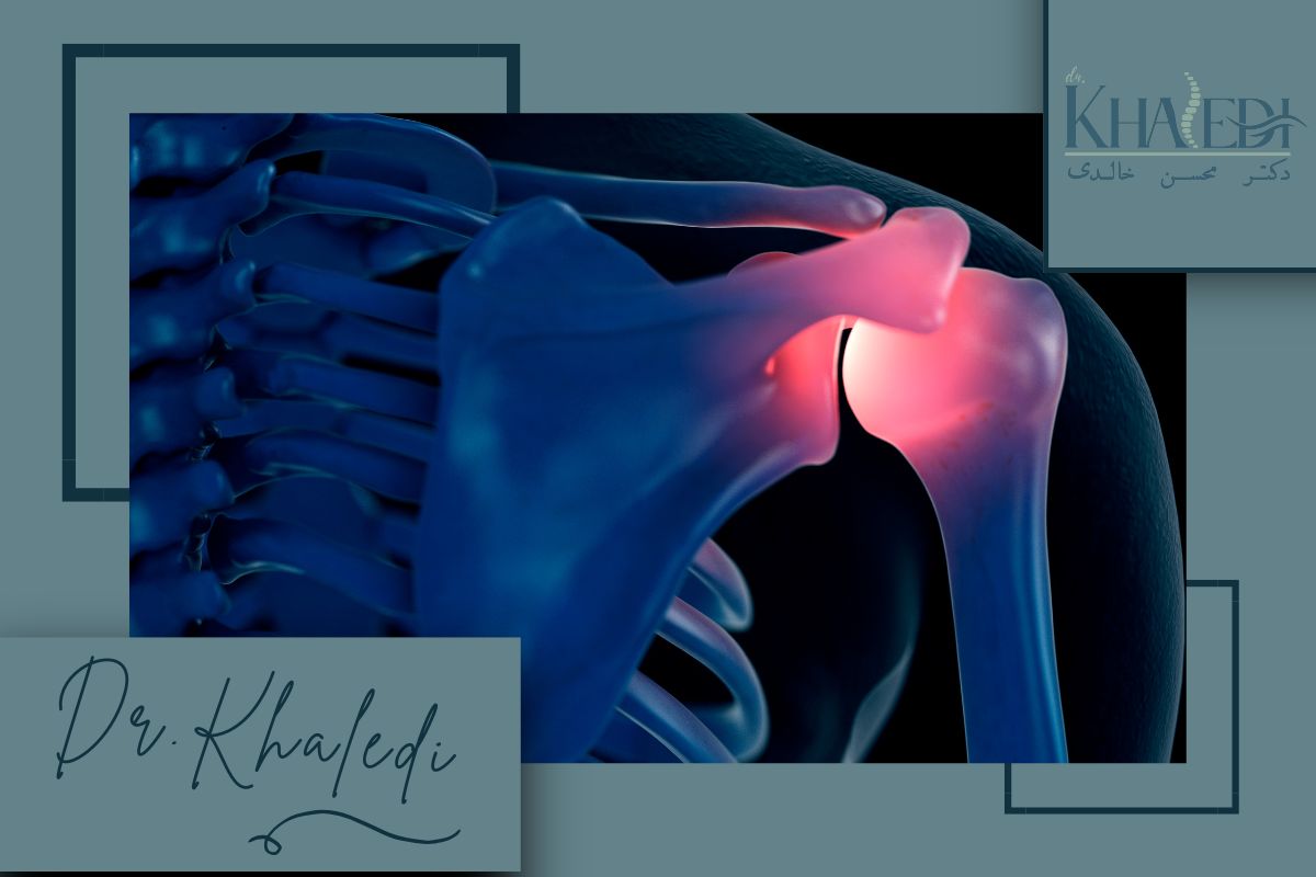 آسیب ها و آرتروز مفصل شانه آکرومیوکلاویکولار؛ از تشخیص تا درمان